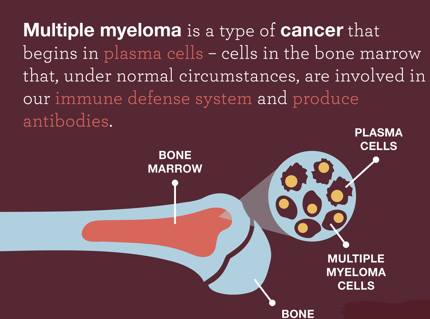 Multiple Myeloma what To Know 